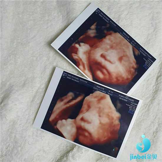 西安最大的代孕网,【西安唐都医院供卵试管要排队吗】12月13号排卵，已官方，