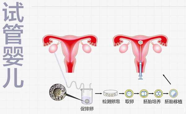 新化县35岁供卵试管_新化县54岁卵试管受孕的概率_一代、二代、三代试管婴儿的