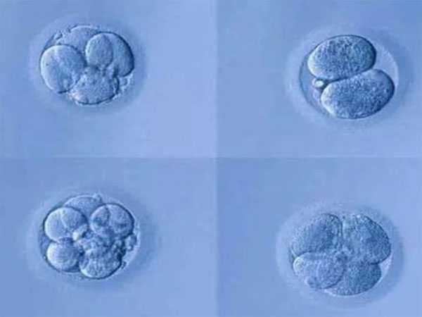 邹城市个人代妈微信群_试管婴儿优胚和普胚的区别，一览本文即可熟知