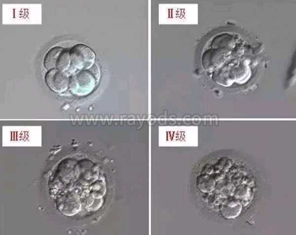 惠安县56岁能借卵生子吗_【胚胎等级】试管胚胎等级是什么意思，等级怎么区分